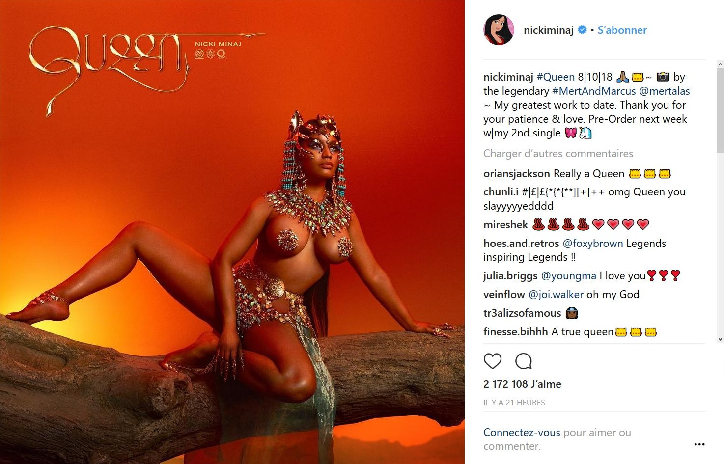 Nicki Minaj : Très dénudée sur la pochette de son prochain album Queen